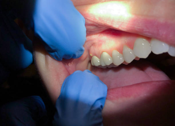 Best Emergency Dental Extractions in Delmont, PA