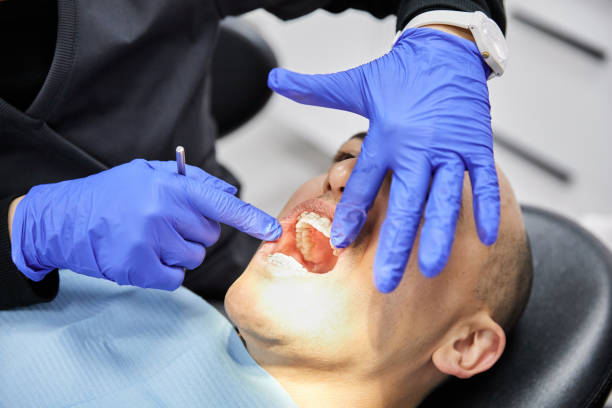 Best Emergency Dentist for Lost Fillings or Crowns in Delmont, PA